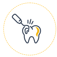 baumgartl-zahnaerzte-zahnerhaltung